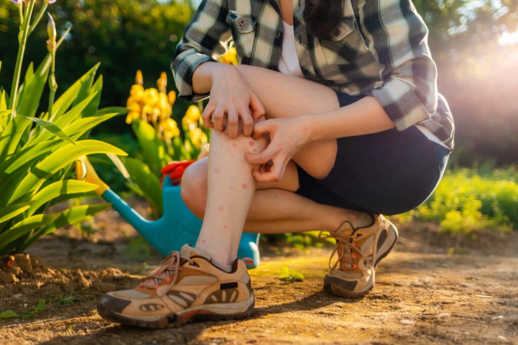 Woman watering her flowers stops to scratch her mosquito bites - Effective Mosquito Control in Oklahoma City - Watson's Weed Control